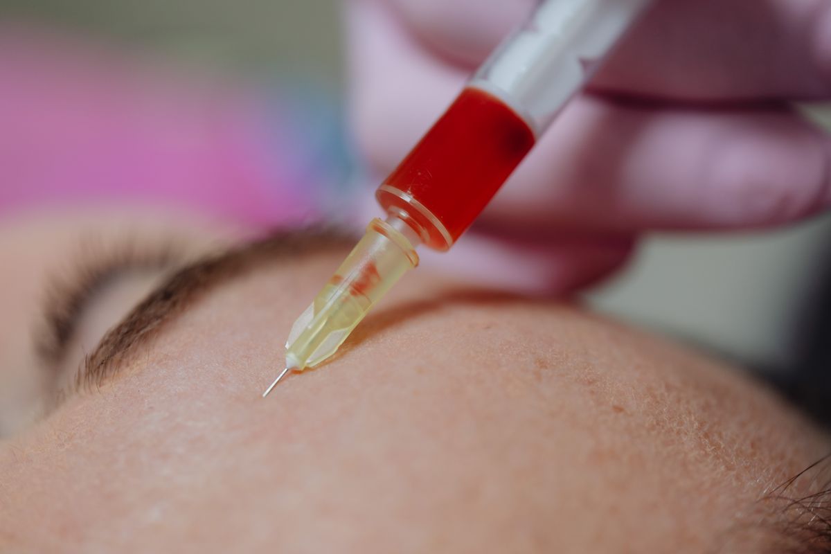 玻尿酸填充剂怎么选：分子量、交联度与注册证解读